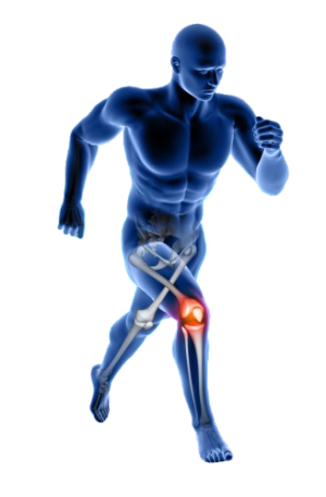 Rheumatoid Arthritis And Osteoarthritis