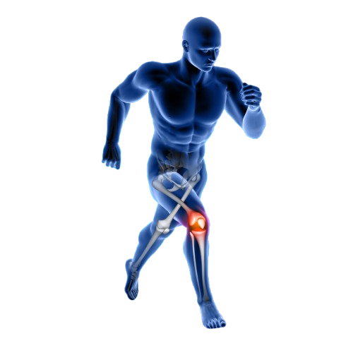 Rheumatoid Arthritis And Osteoarthritis