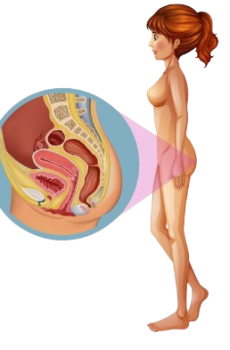 Fibroids Female Care Package