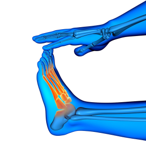 Rheumatoid Arthritis Natural Treatment