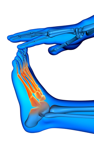 Rheumatoid Arthritis Natural Treatment