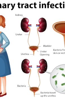 Urinary Infection STD treatment