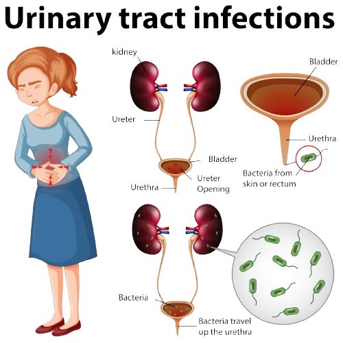Urinary Infection STD treatment
